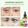 30ml Aloe Vera Augenserum, Augenpflege, Augencreme Gegen Augenringe und Schwellungen,