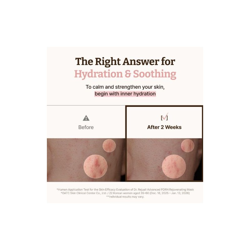Dr.Reju-All [Dr.Reju-All]Advanced PDRN Rejenating Mask (4ea)