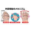 Alphax New Bunion Supporter 1 Pair Medium
