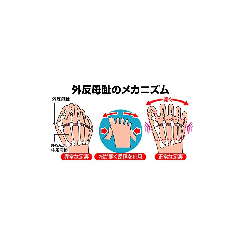 Alphax New Bunion Supporter 1 Pair Medium