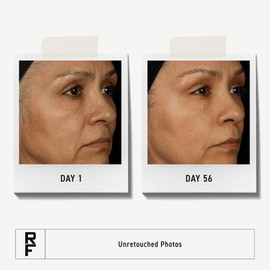 RODAN + FIELDS Total RF Serum 30 mL | Skincare Serums | Hydration, Anti-Aging for Women | Self-Care | Targets Deep Wrinkles & Fine Lines | Morning & Night Use