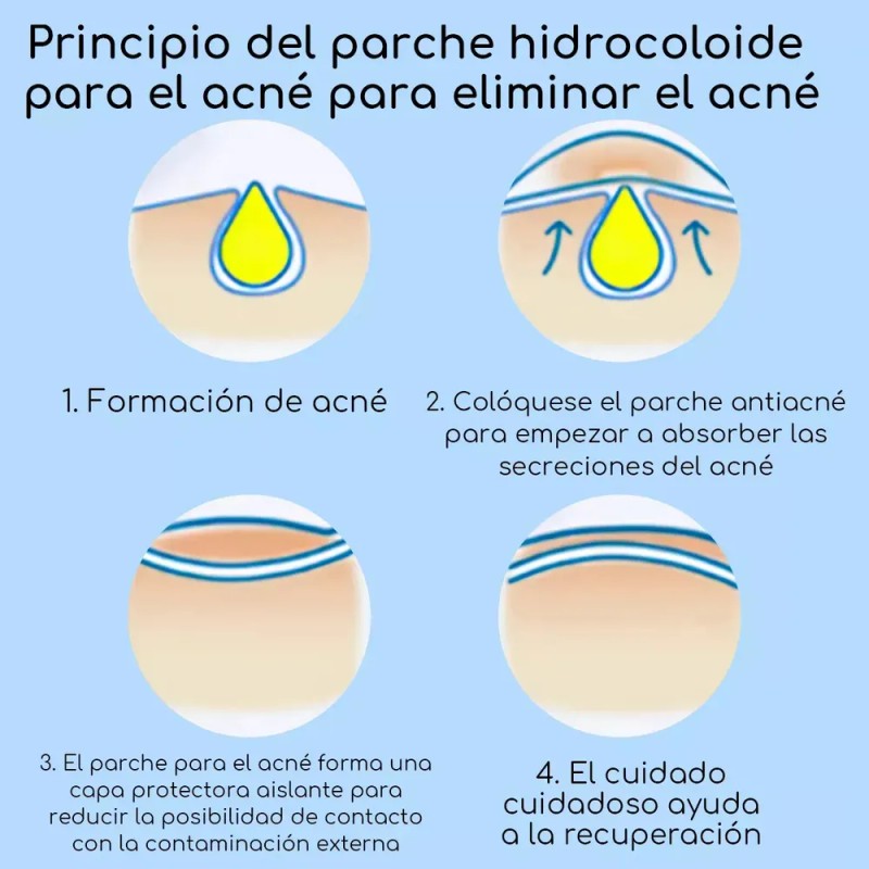Pack de Parches para Acné AuraLux con Hidrocoloide y Ácido