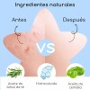 Pack de Parches para Acné AuraLux con Hidrocoloide y Ácido