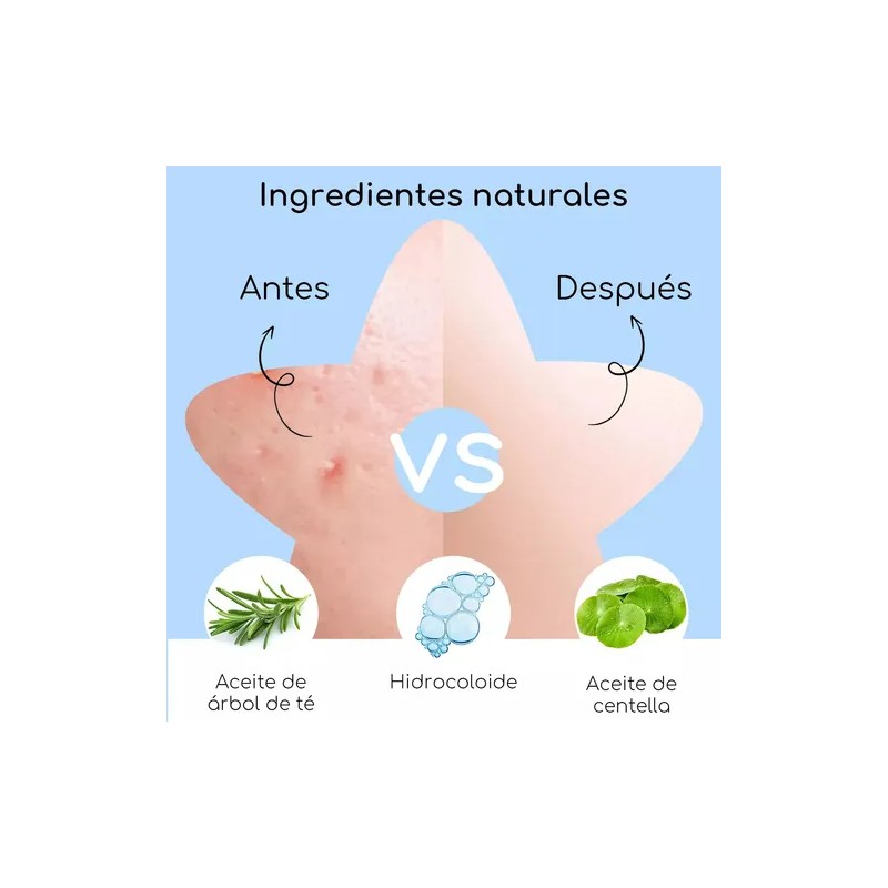 Pack de Parches para Acné AuraLux con Hidrocoloide y Ácido