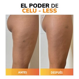 Crema Corporal Celulitis + Reafirmante - Cafeína Pura y Elastina - Tonifica, Hidrata, Mejora La Textura - Quema Grasa - Ingredientes Naturales - Piel De Naranja - Efecto Frío-calor - 300 Ml
