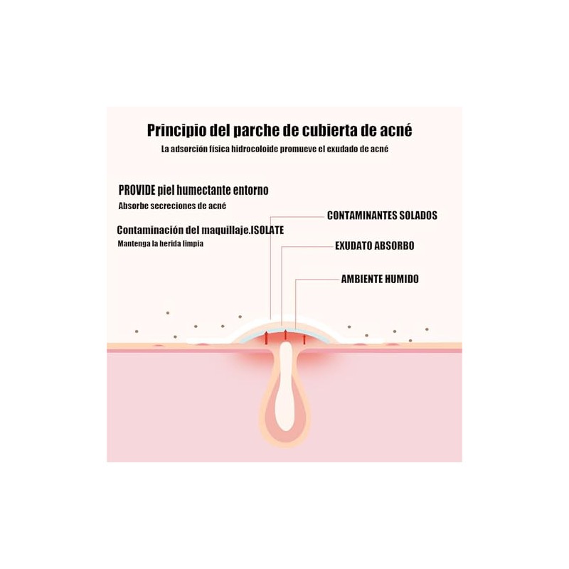 LUHI 200PCS Parches para Acne, Pimple Patch, Parches para Espinillas