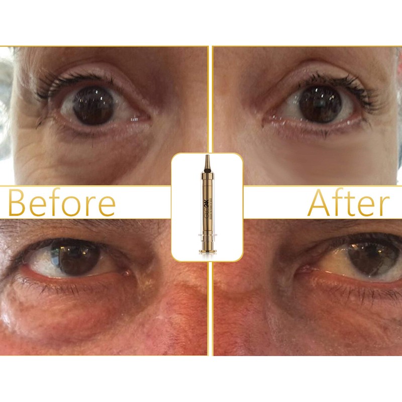 GLO24K Instant Facelift Cream with 24k Gold, Hyaluronic Acid, Peptides,