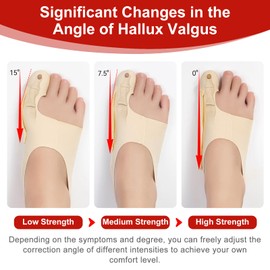POFIBO Hallux Valgus Correction - 1 Pair Hallux Valgus Socks, Bunion Correction, Non-Slip Heel Strap, Hallux Valgus Bandage for Men and Women, Size M