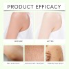 Loción Corporal Exfoliante, Crema Exfoliante Suave Y Suave (