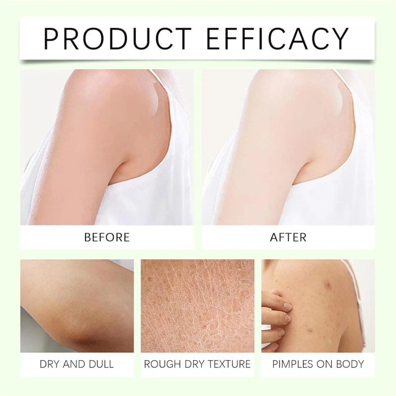 Loción Corporal Exfoliante, Crema Exfoliante Suave Y Suave (