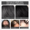 SINYI 2pcs Hair Concealer for Men， Corrector capilar para hombres,