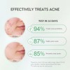 srum clarificante facial con Centella, Salicylic Acid y Niacinamide para