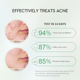 srum clarificante facial con Centella, Salicylic Acid y Niacinamide para textura desigual, frmula suave para todo tipo de piel, 30 ml                 