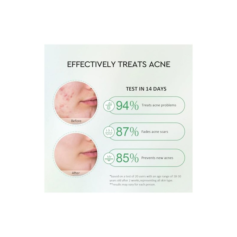 srum clarificante facial con Centella, Salicylic Acid y Niacinamide para