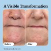 S+sérum Vitamina C Nutre, Reafirma Y Reduce Estiramientos