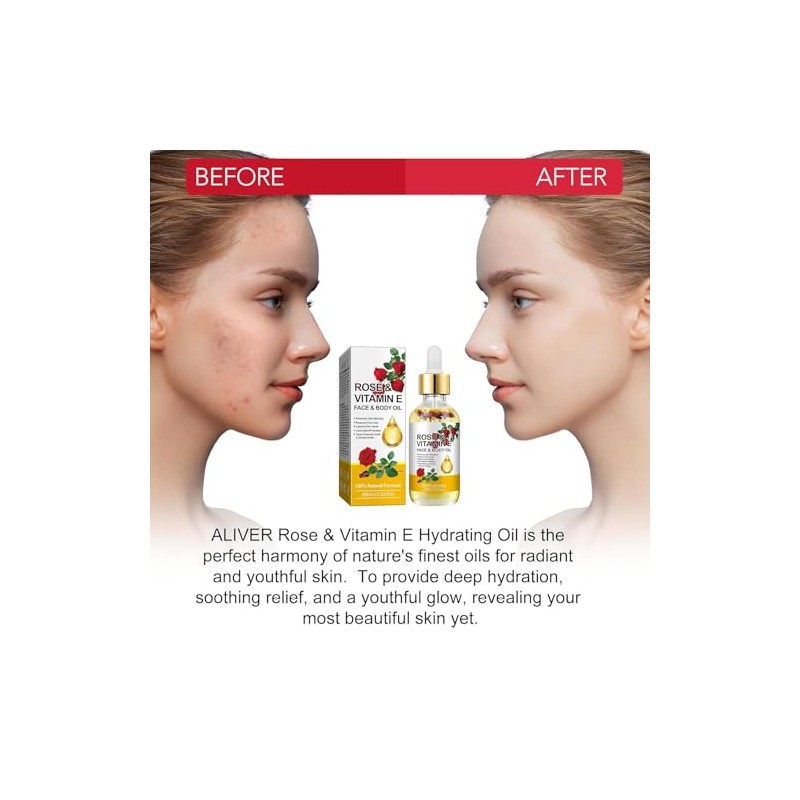 "plomala "Aceite facial con vitamina E, aceite de rosa con