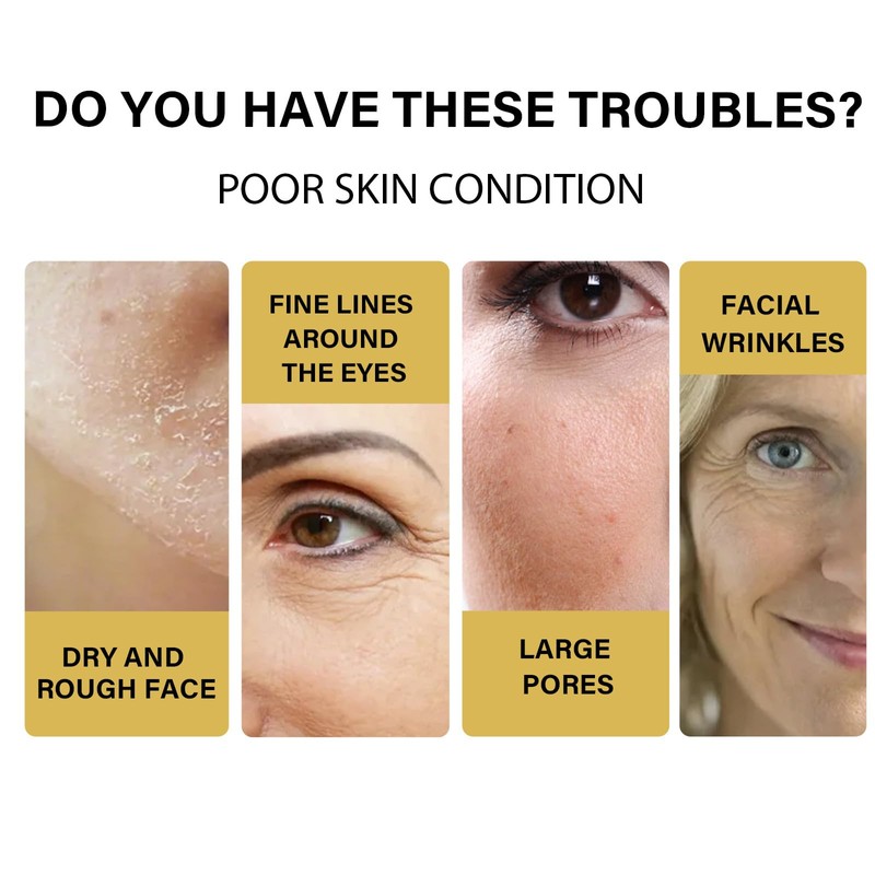 Protein Thread Lifting Set, Protein Thread Face Serum Face Silk