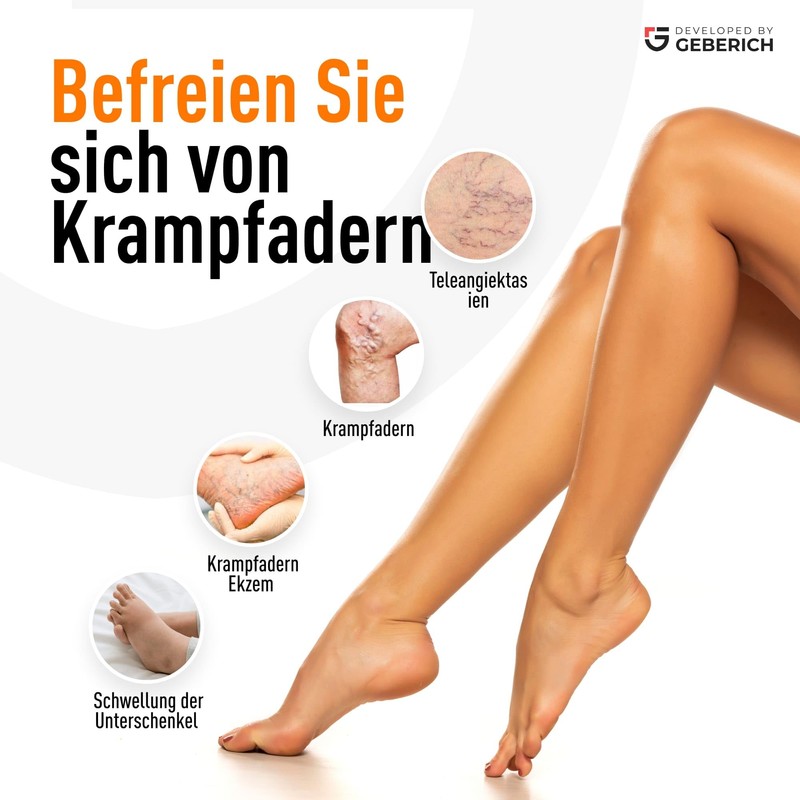 Varitone Varicose Vein Relief Cream - 100ml - Convenient and