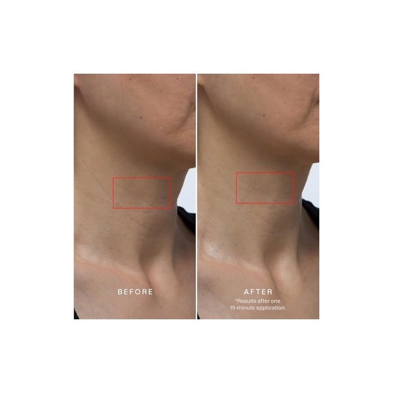 Karuna Máscara de colágeno de hidrogel para cuello y escote