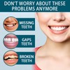Snap on Veneers Dentures Fake Teeth,Snap on Veneers Teeth,Temporary Ve/neers
