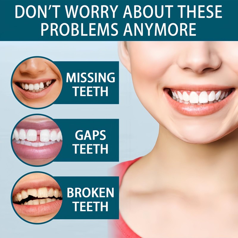 Snap on Veneers Dentures Fake Teeth,Snap on Veneers Teeth,Temporary Ve/neers