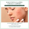 Serum Oxyglow Lactic Acid 10% + Ha Para Piel Normal