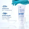 Ducray Kertyol P.S.O. - Treatment Shampoo - For Psoriasis (Psoriasis)