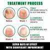 Ginger nail treatment nail support nail care Moisture Blend Cosmetic