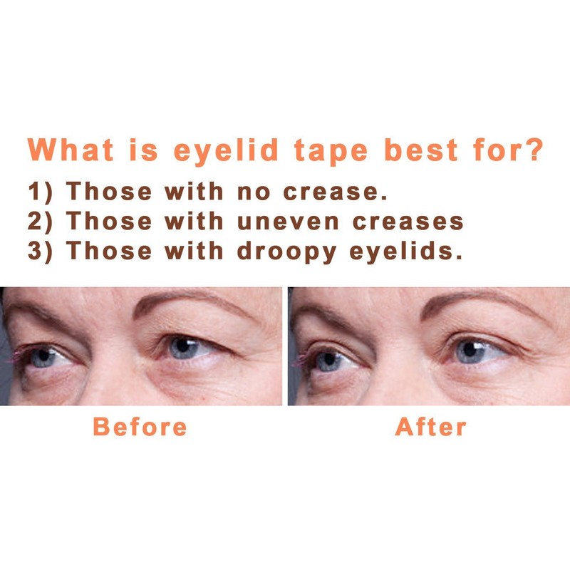 magic invisible Girl Size (S) – Eyelid Lifting Without OP [1X60PAAR]