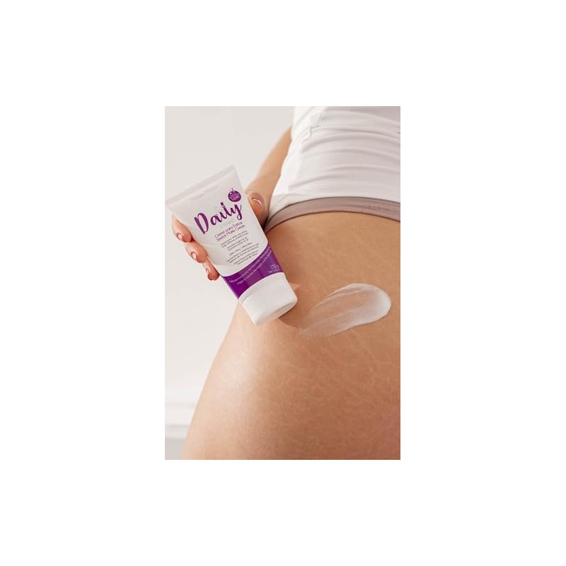 Michelle Marques Crema para Estrías