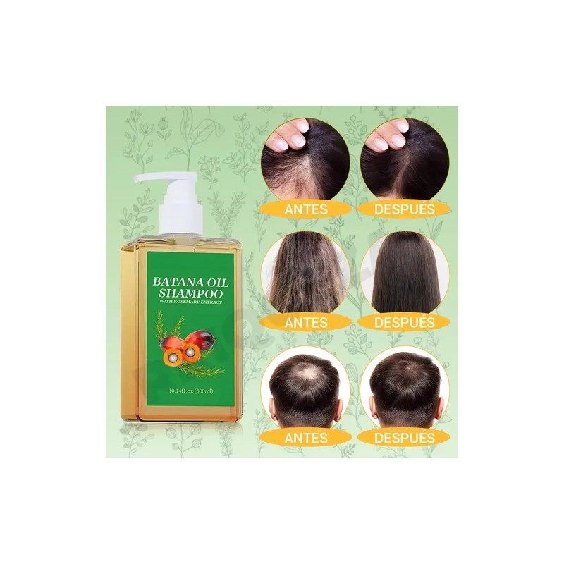 Champú Aceite Batana 300ml Dar Volumen