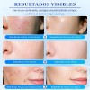 Acne Buster Loción Secante Con Ácido Salicílico 10ml Todo Tipo