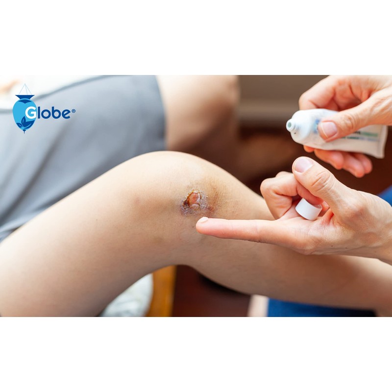 Globe (12 Pack) Triple Antibiotic First Aid Ointment 1 oz,