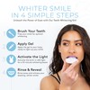 Bloom Teeth Whitening Kit – Fast Acting, 35% Carbemide Peroxide