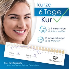 Whitesensation® Premium Teeth Whitening Bleaching Set with LED Rail, Gel Pen & Strips [THE ORIGINAL] - Teeth Whitening for White Teeth in 6 Days - Teeth Whitening & Whitening - Teeth Whitening Kit