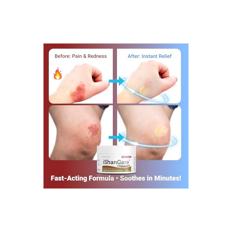 First Aid Burn Ointment with Camellia Oil - Natural Relief