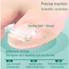 Professional Ingrown Toenail Corrector Kit - Curved Nail Strips &