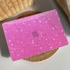 AKIT Compatible with MacBook Pro 14 inch Case Sparkly 2025-2021