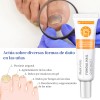 Pomada Antifúngica Para Uñas 30g,tratamiento Contra Hongos