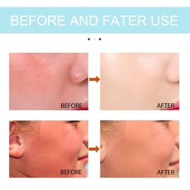 Cenntella Asiatica Sunscreen Spf 50+Pa++++,Centella Sunscreen Spf50 Factor 50 Sun Cream,Korean Sun-Screen Spf 50 Face,S/unscreen Stick,Spf50 Face Moisturiser,Sun Cream,C/entella S/unscreen