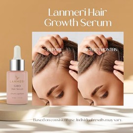 Lanmeri Vegan Hair Growth Serum - Natural Hair Regrowth and Hair Loss Treatments for Women & Men - Scalp Serum for Thinning Hair and Hair Loss - Fuller-looking, Thicker and Healthier Hair in 90 Days, All Hair Types