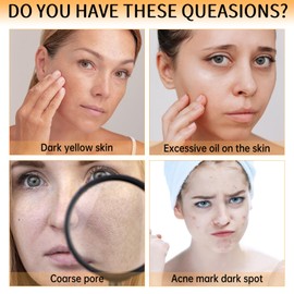 Niacinamide Serum Facial Moisturizing,10% Niacinamide + 1% Zinc,Tackles Blemishes, Minimises Pore Appearance,Anti Aging& Wrinkle Face Serum For All Skin Types(30 Ml)