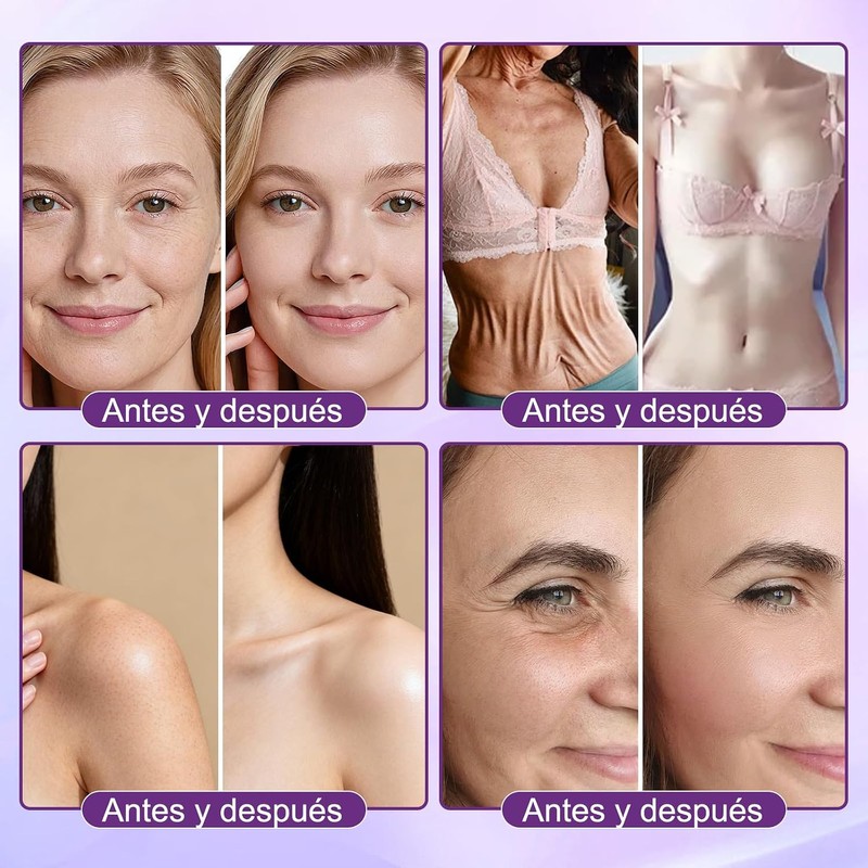 2PCS Crema Reparadora de la Piel 10 en 1, Crema