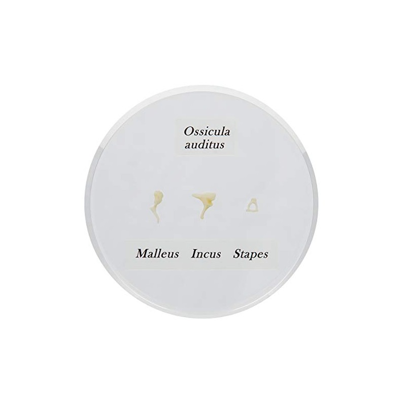 3B Scientific E13 Life Size Auditory Ossicles Model