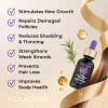 Sérum Para El Crecimiento Del Cabello, Espesante Para Folícu