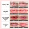 Lip Lightening Balm Dark Black Removal Exfoliation Pigmentation Fade Dull