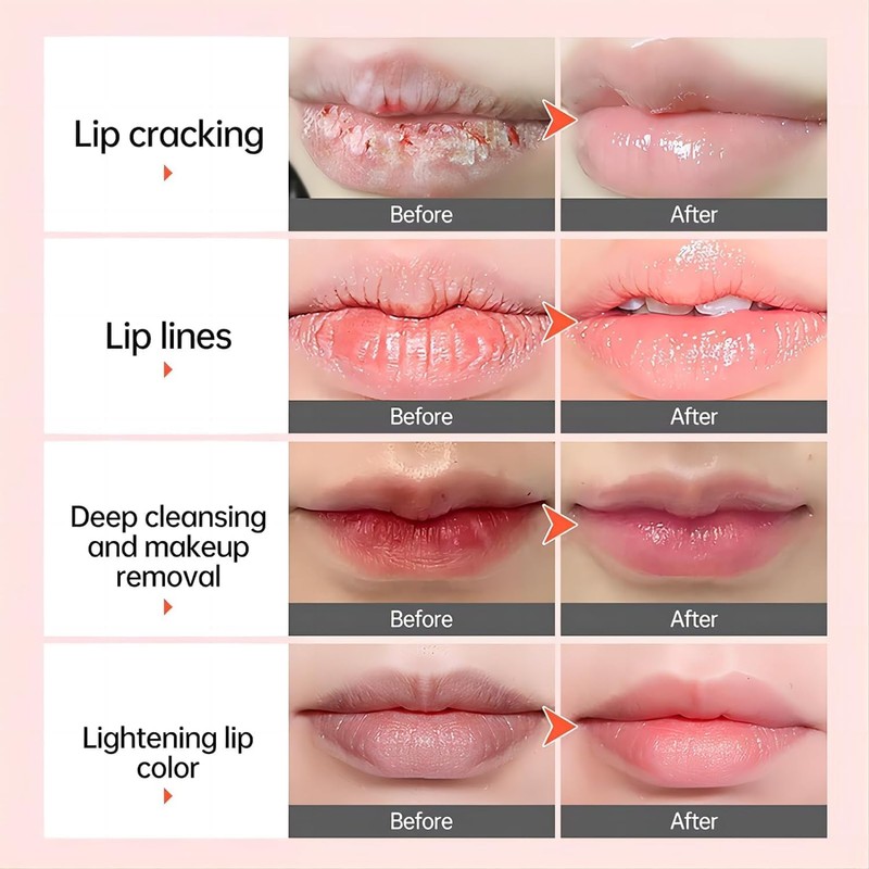 Lip Lightening Balm Dark Black Removal Exfoliation Pigmentation Fade Dull