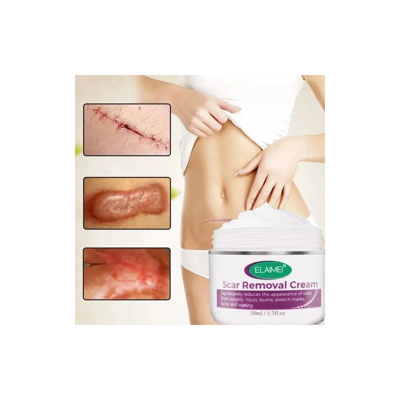 Kit Cicatrices Cirugías Cesárea Crema Y Parche Silicón