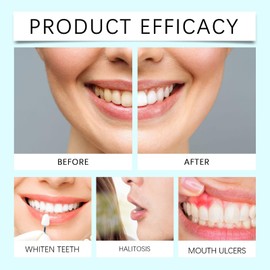 100G Nicotinamide Teeth Whitenings Powder,Teeth Whitening Powder Dentist Approved,Professional Teeth Whitening Powd/er,Enamel-Safe & Sensitivity-Free,Tooth Whiten/ing Powd/er,Powd/er Toothpaste