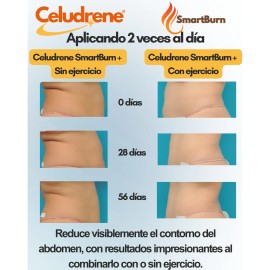 Gel Reductor Corporal Quema Grasa Celudrene Smartburn